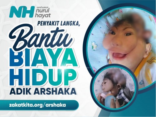 Penyakit Langka, Bantu Biaya Hidup Adik Arshaka