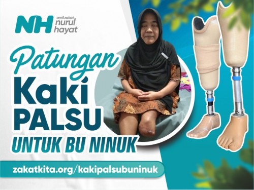 Kaki Palsu untuk Bu Ninuk