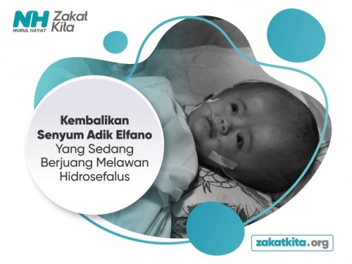 Perjuangan Si Kecil Elfano (Penderita Hidrosefalus)